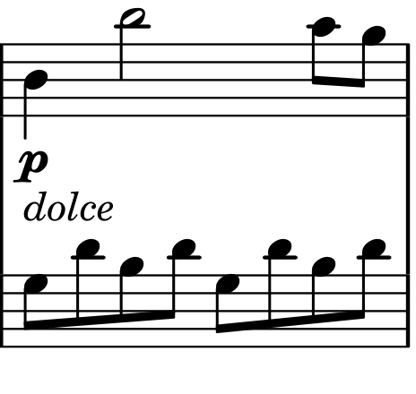 ピアノ、ドルチェ。右手はシ4の四分音符から、一オクターブ上のシ5の二分音符へ跳び、そのあとラ・ソの八分音符で下がる。左手はソ・レ・シ・レの八分音符の伴奏を続ける。