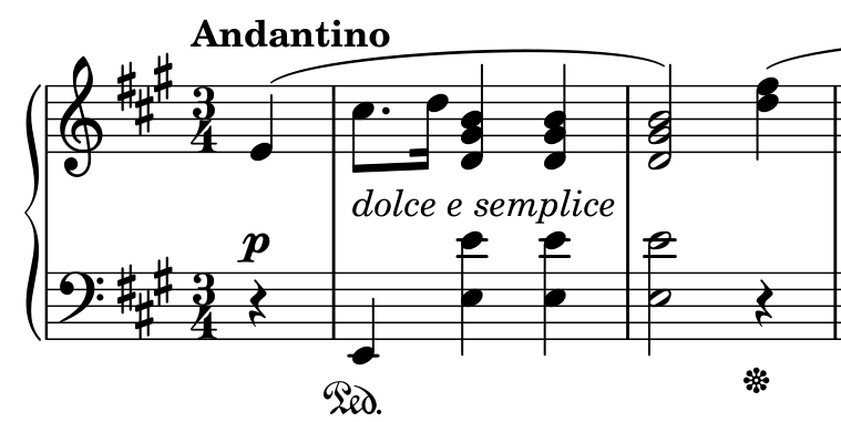 Chopin opening detail: E4 upbeat, the dotted rhythm in bar 1, then the held chord and a new upbeat in bar 2